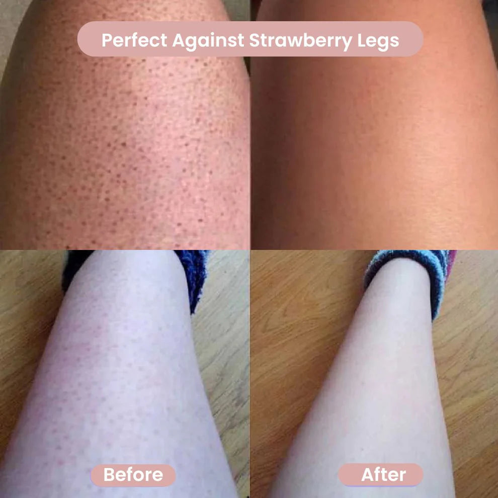 SleekTrim™ 2-in-1 Women's Shaver